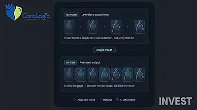 [Seed] 医療AIスタートアップCorologic、放射線被曝を軽減する心血管ソリューションでシード投資を誘致